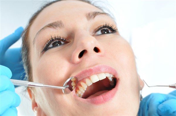 Zahnreinigung/Dentalhygiene